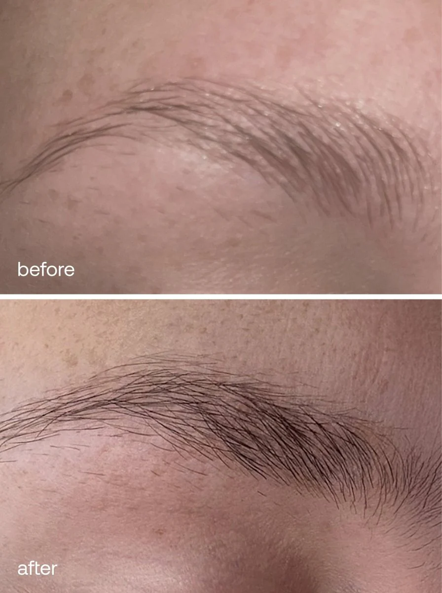 Eyebrow Growth Serum - Image 4