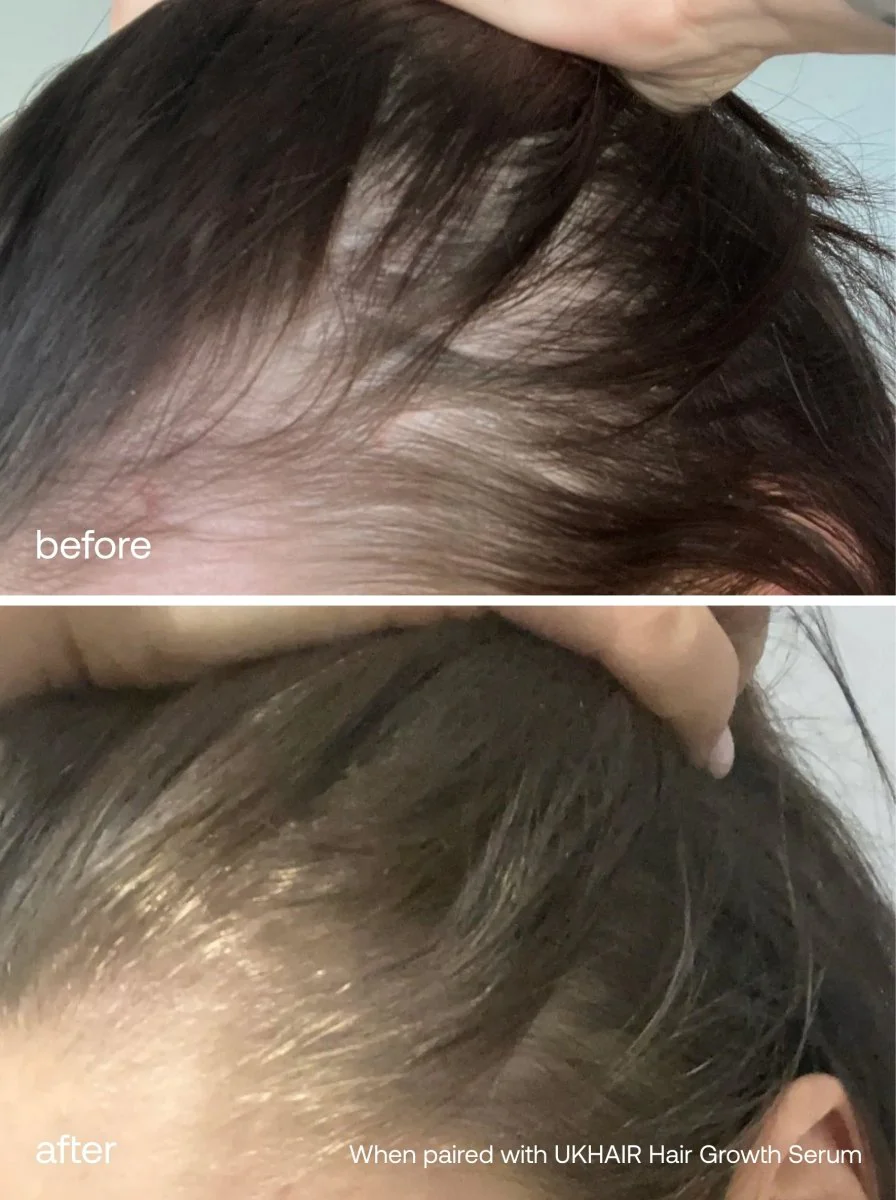 Lash Growth Serum + Hair Repair Mask Set - Image 7