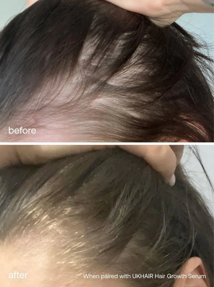 The Grow Longer Hair Set - Image 10