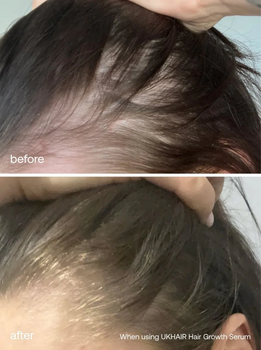 The Hair Care Essentials - Image 4