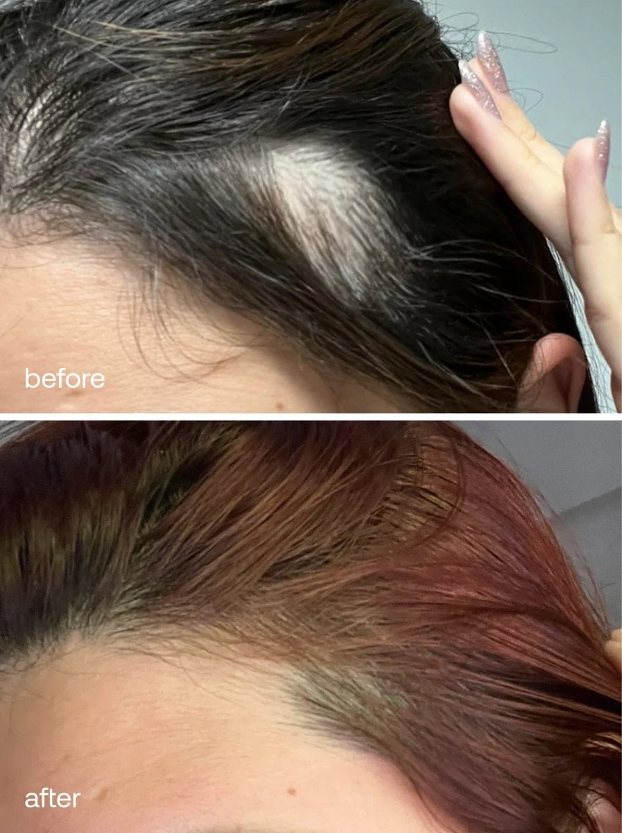Hair Growth Serum - Image 5