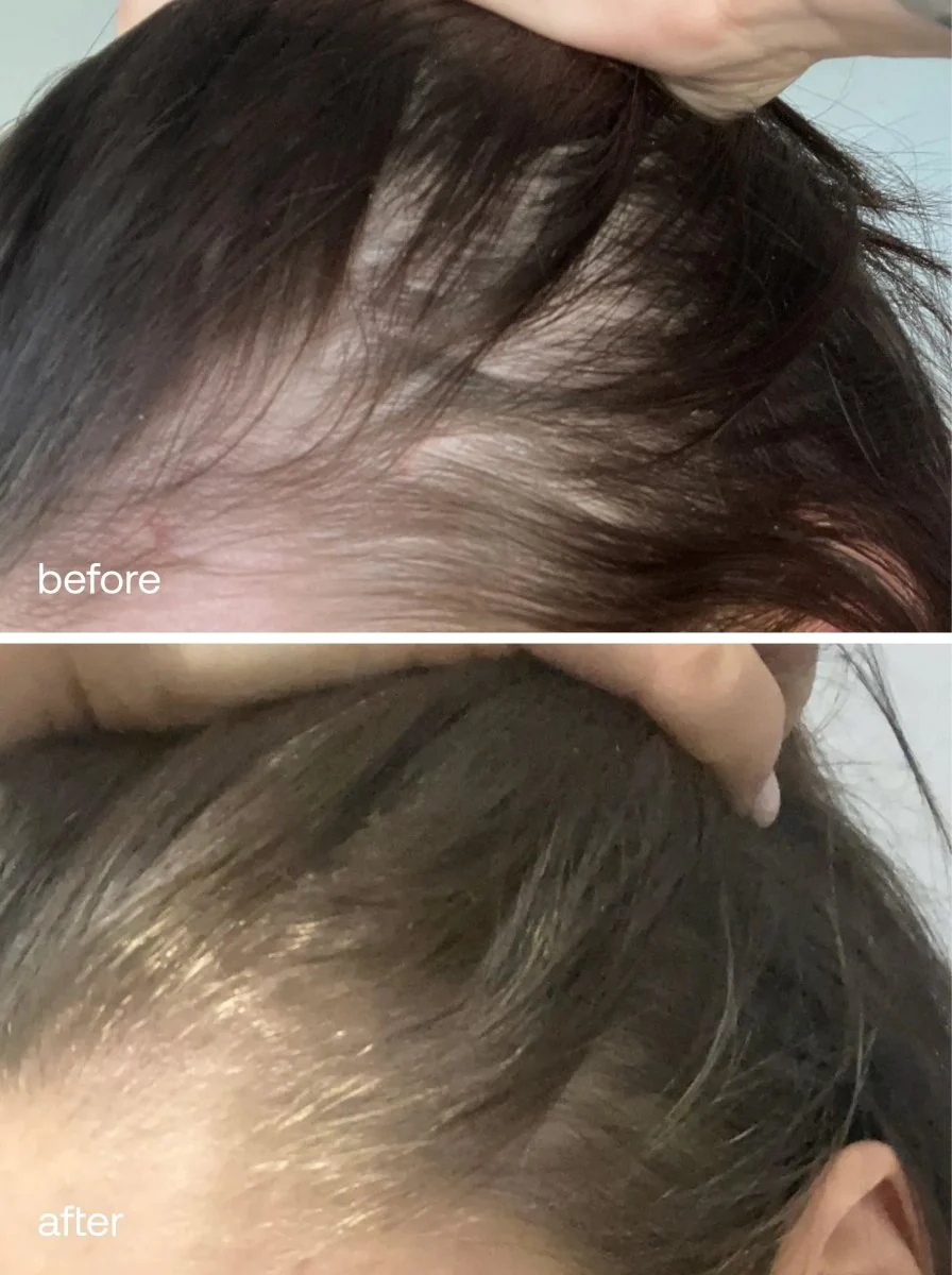 Hair Vitamins - Image 5